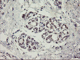 MYNN Antibody - IHC of paraffin-embedded Human breast tissue using anti-MYNN mouse monoclonal antibody.