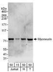 MYNN Antibody - Detection of Human Myoneurin by Western Blot. Samples: Whole cell lysate from Jurkat (15 and 50 ug), HeLa (H; 50 ug) and 293T (T; 50 ug) cells. Antibodies: Affinity purified rabbit anti-Myoneurin antibody used for WB at 1 ug/ml. Detection: Chemiluminescence with an exposure time of 3 minutes.