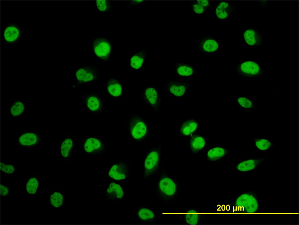 MYNN Antibody - Immunofluorescence of monoclonal antibody to MYNN on HeLa cell. [antibody concentration 10 ug/ml]