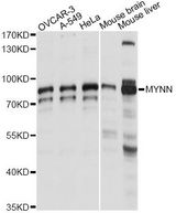 MYNN Antibody - Western blot analysis of extracts of various cell lines, using MYNN antibody at 1:1000 dilution. The secondary antibody used was an HRP Goat Anti-Rabbit IgG (H+L) at 1:10000 dilution. Lysates were loaded 25ug per lane and 3% nonfat dry milk in TBST was used for blocking. An ECL Kit was used for detection and the exposure time was 1s.