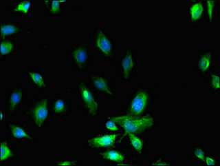 MYO10 / Myosin-X Antibody - Immunofluorescent analysis of U251 cells diluted at 1:100 and Alexa Fluor 488-congugated AffiniPure Goat Anti-Rabbit IgG(H+L)