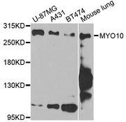 MYO10 / Myosin-X Antibody - Western blot analysis of extracts of various cell lines, using MYO10 antibody at 1:1000 dilution. The secondary antibody used was an HRP Goat Anti-Rabbit IgG (H+L) at 1:10000 dilution. Lysates were loaded 25ug per lane and 3% nonfat dry milk in TBST was used for blocking. An ECL Kit was used for detection and the exposure time was 90s.