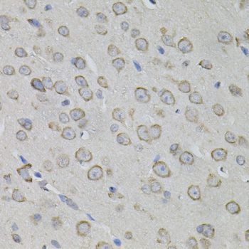 MYO10 / Myosin-X Antibody - Immunohistochemistry of paraffin-embedded mouse brain using MYO10 antibody (40x lens).