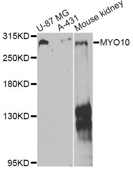 MYO10 / Myosin-X Antibody - Western blot analysis of extracts of various cell lines, using MYO10 antibody at 1:1000 dilution. The secondary antibody used was an HRP Goat Anti-Rabbit IgG (H+L) at 1:10000 dilution. Lysates were loaded 25ug per lane and 3% nonfat dry milk in TBST was used for blocking. An ECL Kit was used for detection and the exposure time was 20s.