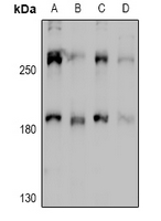 MYO10 / Myosin-X Antibody - Western blot analysis of MYO10 expression in Hela (A), A2780 (B), C6 (C), NIH3T3 (D) whole cell lysates.
