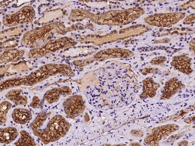 MYO10 / Myosin-X Antibody - Immunochemical staining of human MYO10 in human kidney with rabbit polyclonal antibody at 1:100 dilution, formalin-fixed paraffin embedded sections.