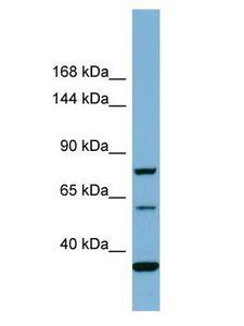 MYO16 Antibody - MYO16 antibody Western Blot of COLO205. Antibody dilution: 1 ug/ml.  This image was taken for the unconjugated form of this product. Other forms have not been tested.