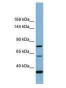 MYO16 Antibody - MYO16 antibody Western Blot of COLO205. Antibody dilution: 1 ug/ml.  This image was taken for the unconjugated form of this product. Other forms have not been tested.