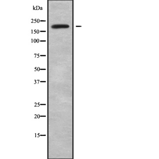 MYO16 Antibody - Western blot analysis of MYO16 using Jurkat whole cells lysates