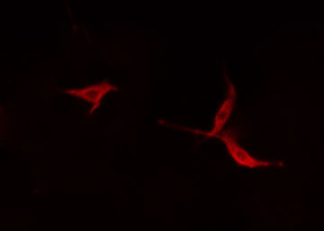 MYO16 Antibody - Staining HepG2 cells by IF/ICC. The samples were fixed with PFA and permeabilized in 0.1% Triton X-100, then blocked in 10% serum for 45 min at 25°C. The primary antibody was diluted at 1:200 and incubated with the sample for 1 hour at 37°C. An Alexa Fluor 594 conjugated goat anti-rabbit IgG (H+L) antibody, diluted at 1/600, was used as secondary antibody.