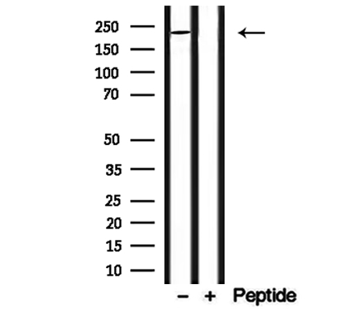 MYO16 Antibody - Western blot analysis of extracts of mouse spleen using MYO16 antibody.