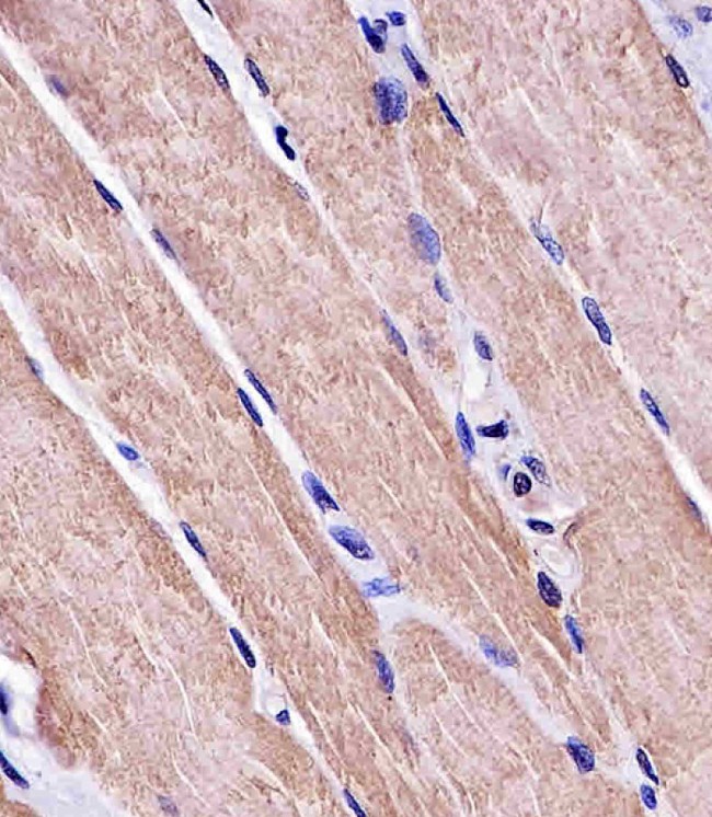 MYO18B / Myosin 18B Antibody - MYO18B Antibody staining MYO18B in human skeletal muscle tissue sections by Immunohistochemistry (IHC-P - paraformaldehyde-fixed, paraffin-embedded sections). Tissue was fixed with formaldehyde and blocked with 3% BSA for 0. 5 hour at room temperature; antigen retrieval was by heat mediation with a citrate buffer (pH6). Samples were incubated with primary antibody (1/25) for 1 hours at 37°C. A undiluted biotinylated goat polyvalent antibody was used as the secondary antibody.