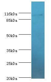 MYO19 / Myosin XIX Antibody - Western blot. All lanes: MYO19 antibody at 2 ug/ml+A549 whole cell lysate. Secondary antibody: Goat polyclonal to rabbit at 1:10000 dilution. Predicted band size: 109 kDa. Observed band size: 109 kDa.  This image was taken for the unconjugated form of this product. Other forms have not been tested.