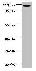 MYO19 / Myosin XIX Antibody - Western blot All lanes: MYO19 antibody at 2µg/ml + A549 whole cell lysate Secondary Goat polyclonal to rabbit IgG at 1/10000 dilution Predicted band size: 110, 36, 72, 87 kDa Observed band size: 110 kDa