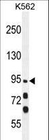 MYO19 / Myosin XIX Antibody - MYO19 Antibody western blot of K562 cell line lysates (35 ug/lane). The MYO19 antibody detected the MYO19 protein (arrow).
