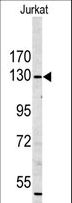 MYO1A Antibody - Western blot of MYO1A antibody (Center S291) in Jurkat cell line lysates (35 ug/lane). MYO1A (arrow) was detected using the purified antibody.