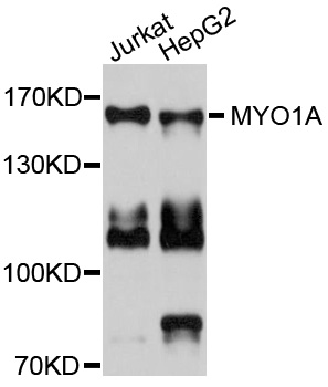 MYO1A Antibody - Western blot analysis of extracts of various cells.