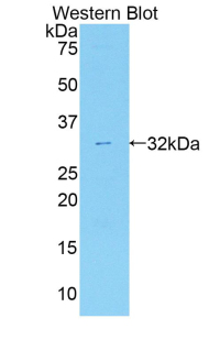 MYO1C Antibody - Western blot of recombinant MYO1C.  This image was taken for the unconjugated form of this product. Other forms have not been tested.