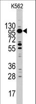 MYO1C Antibody - Western blot of MYO1C Antibody in K562 cell line lysates (35 ug/lane). MYO1C (arrow) was detected using the purified antibody.