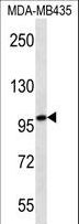 MYO1C Antibody - MYO1C western blot of MDA-MB435 cell line lysates (35 ug/lane). The MYO1C antibody detected the MYO1C protein (arrow).