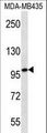 MYO1C Antibody - MYO1C western blot of MDA-MB435 cell line lysates (35 ug/lane). The MYO1C antibody detected the MYO1C protein (arrow).