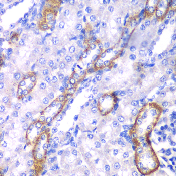 MYO1C Antibody - Immunohistochemistry of paraffin-embedded rat kidney tissue.