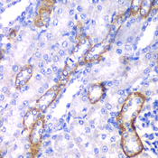 MYO1C Antibody - Immunohistochemistry of paraffin-embedded rat kidney tissue.