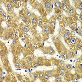 MYO1C Antibody - Immunohistochemistry of paraffin-embedded human liver injury tissue.