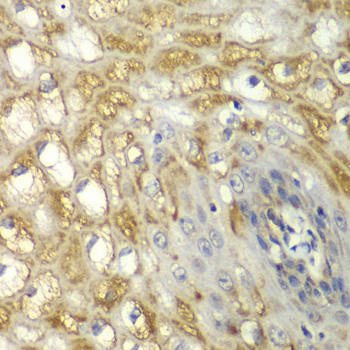 MYO1C Antibody - Immunohistochemistry of paraffin-embedded human esophageal tissue.