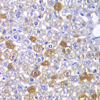 MYO1C Antibody - Immunohistochemistry of paraffin-embedded mouse liver tissue.