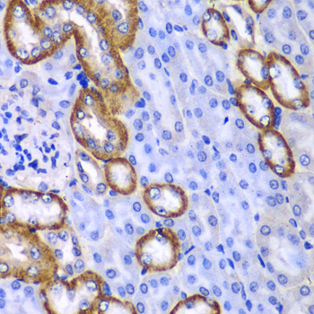 MYO1C Antibody - Immunohistochemistry of paraffin-embedded mouse kidney tissue.