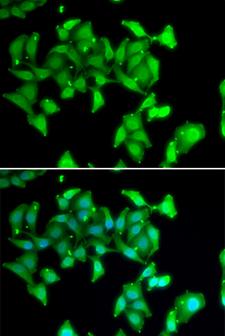 MYO1C Antibody - Immunofluorescence analysis of U20S cells.