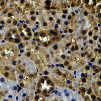 MYO1C Antibody - Immunohistochemical analysis of Myosin Ic staining in rat kidney formalin fixed paraffin embedded tissue section. The section was pre-treated using heat mediated antigen retrieval with sodium citrate buffer (pH 6.0). The section was then incubated with the antibody at room temperature and detected using an HRP conjugated compact polymer system. DAB was used as the chromogen. The section was then counterstained with hematoxylin and mounted with DPX.