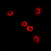MYO1C Antibody - Immunofluorescent analysis of Myosin Ic staining in U2OS cells. Formalin-fixed cells were permeabilized with 0.1% Triton X-100 in TBS for 5-10 minutes and blocked with 3% BSA-PBS for 30 minutes at room temperature. Cells were probed with the primary antibody in 3% BSA-PBS and incubated overnight at 4 deg C in a humidified chamber. Cells were washed with PBST and incubated with a DyLight 594-conjugated secondary antibody (red) in PBS at room temperature in the dark.