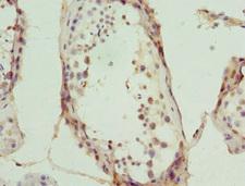 MYO1C Antibody - Immunohistochemistry of paraffin-embedded human testis tissue at dilution 1:100