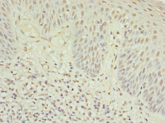 MYO1C Antibody - Immunohistochemistry of paraffin-embedded human tonsil tissue at dilution 1:100