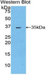 MYO1D Antibody - Western blot of recombinant MYO1D.  This image was taken for the unconjugated form of this product. Other forms have not been tested.