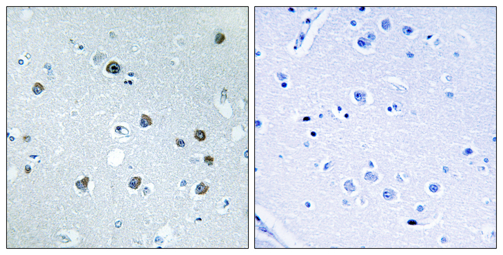 MYO1D Antibody - Immunohistochemistry analysis of paraffin-embedded human brain tissue, using MYO1D Antibody. The picture on the right is blocked with the synthesized peptide.