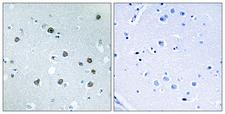 MYO1D Antibody - Immunohistochemistry analysis of paraffin-embedded human brain tissue, using MYO1D Antibody. The picture on the right is blocked with the synthesized peptide.