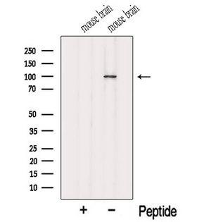 MYO1D Antibody - Western blot analysis of extracts of mouse brain tissue using MYO1D antibody. The lane on the left was treated with blocking peptide.