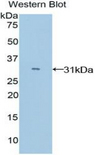 MYO1E / Myosin IE Antibody - Western blot of recombinant MYO1E / Myosin IE.  This image was taken for the unconjugated form of this product. Other forms have not been tested.