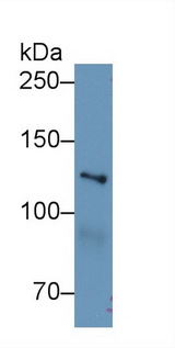 MYO1E / Myosin IE Antibody - Western Blot; Sample: Human Hela cell lysate; Primary Ab: 1µg/ml Rabbit Anti-Mouse MYO1E Antibody Second Ab: 0.2µg/mL HRP-Linked Caprine Anti-Rabbit IgG Polyclonal Antibody