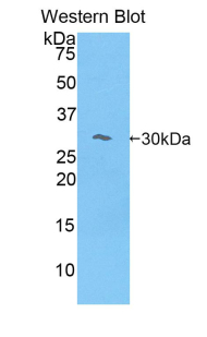 MYO1E / Myosin IE Antibody - Western blot of recombinant MYO1E / Myosin IE.  This image was taken for the unconjugated form of this product. Other forms have not been tested.