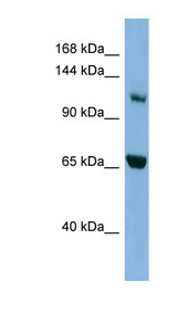 MYO1E / Myosin IE Antibody - MYO1E antibody Western blot of HepG2 cell lysate. This image was taken for the unconjugated form of this product. Other forms have not been tested.