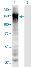 MYO1E / Myosin IE Antibody - Western Blot analysis of MYO1E expression in transfected 293T cell line by MYO1E monoclonal antibody (M02), clone 7A5.Lane 1: MYO1E transfected lysate (Predicted MW: 127.1 KDa).Lane 2: Non-transfected lysate.