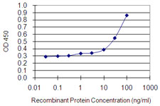 MYO1E / Myosin IE Antibody - Detection limit for recombinant GST tagged MYO1E is 0.3 ng/ml as a capture antibody.