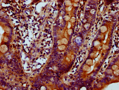 MYO1E / Myosin IE Antibody - Immunohistochemistry Dilution at 1:700 and staining in paraffin-embedded human small intestine tissue performed on a Leica BondTM system. After dewaxing and hydration, antigen retrieval was mediated by high pressure in a citrate buffer (pH 6.0). Section was blocked with 10% normal Goat serum 30min at RT. Then primary antibody (1% BSA) was incubated at 4°C overnight. The primary is detected by a biotinylated Secondary antibody and visualized using an HRP conjugated SP system.