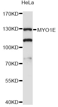 MYO1E / Myosin IE Antibody - Western blot analysis of extracts of HeLa cells, using MYO1E antibody at 1:3000 dilution. The secondary antibody used was an HRP Goat Anti-Rabbit IgG (H+L) at 1:10000 dilution. Lysates were loaded 25ug per lane and 3% nonfat dry milk in TBST was used for blocking. An ECL Kit was used for detection and the exposure time was 60s.