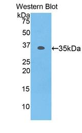 MYO1F Antibody - Western Blot; Sample: Recombinant protein.