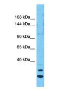 MYO1F Antibody - Western blot of MYO1F Antibody with human RPMI-8226 Whole Cell lysate.  This image was taken for the unconjugated form of this product. Other forms have not been tested.